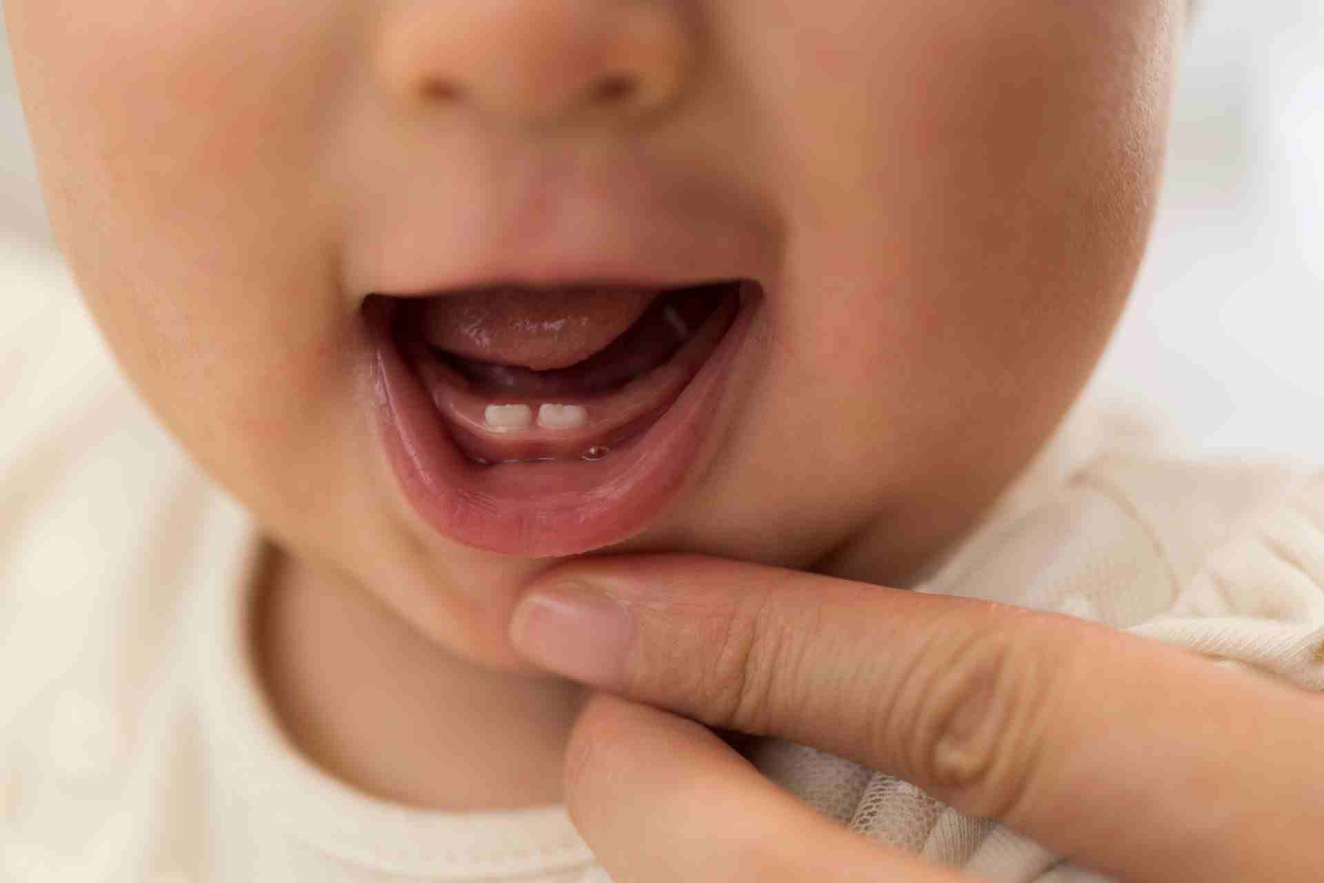 Can Teething Cause A Rash?