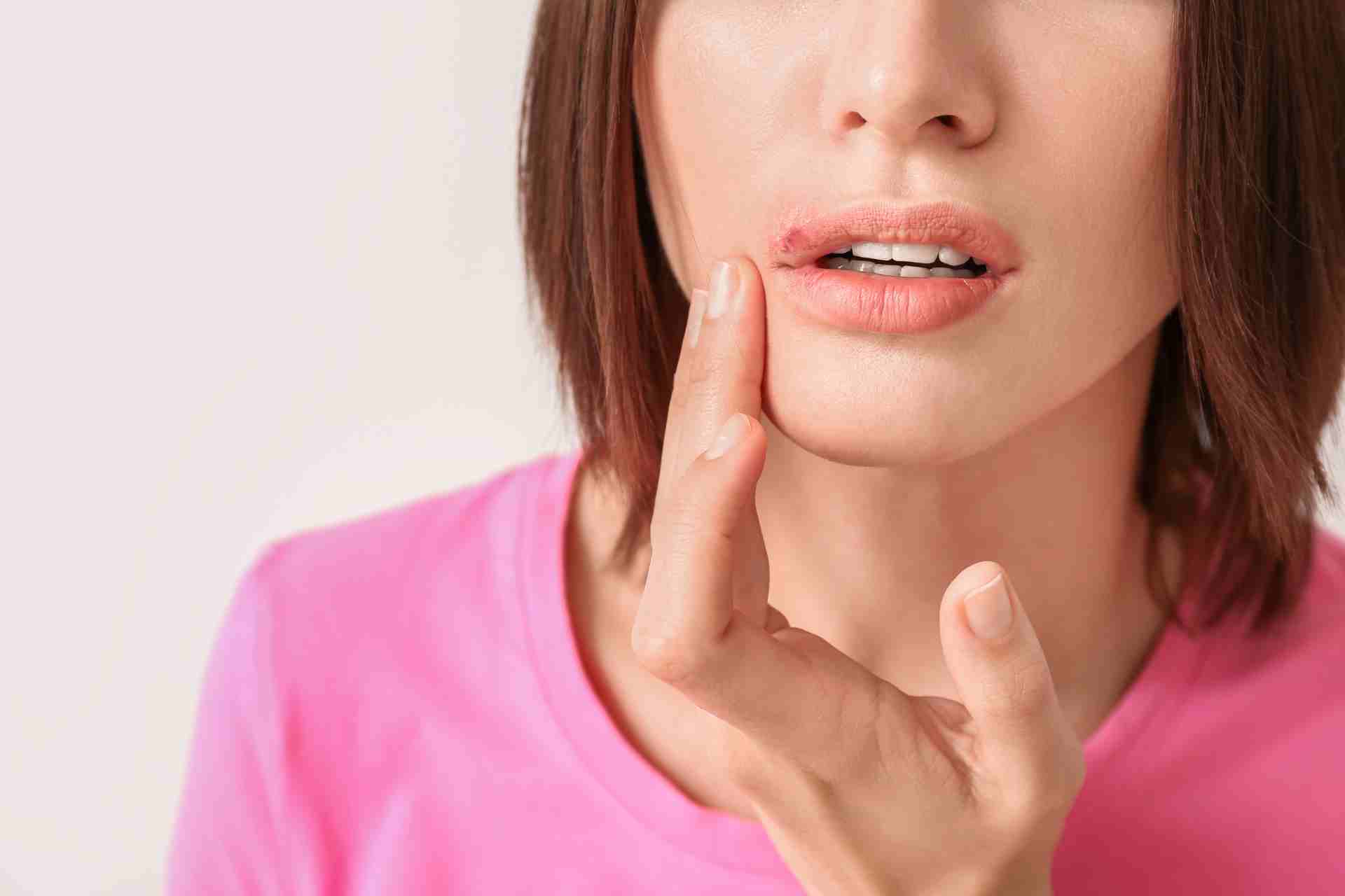 How Long Are Cold Sores Contagious?