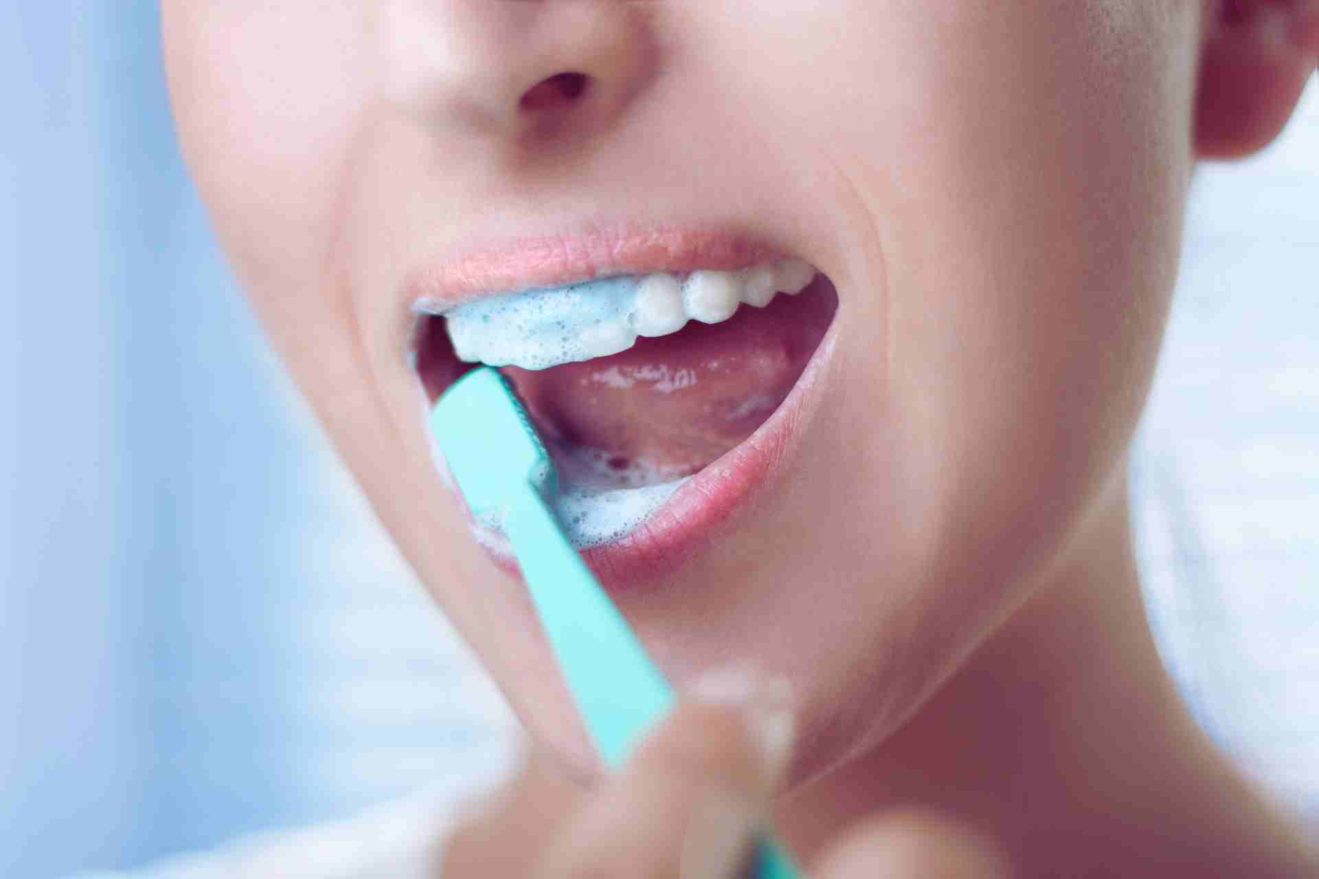 Best Toothpaste For Veneers